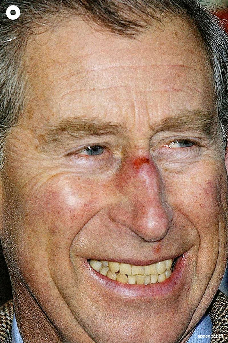 charles_health_history_SPACEBAR_Photo_V01_2ba2df5bf8.jpg